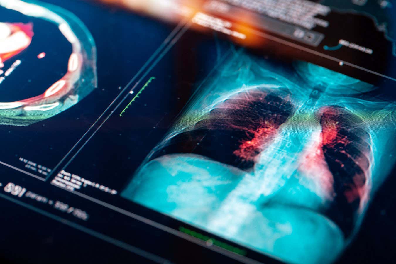 Medical MRI Scan on digital screen